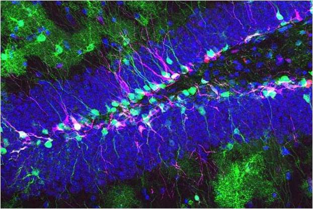 Transplanting neurons, present art and future promise